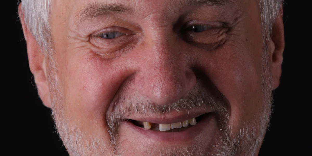 Smile Today Concept