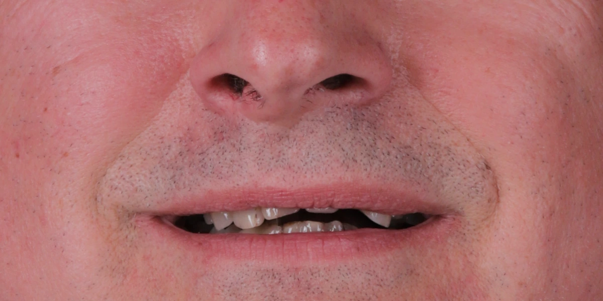 Smile Today Concept
