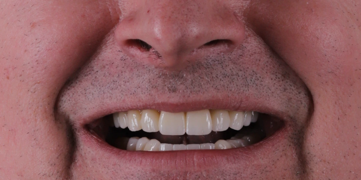 Smile Today Concept